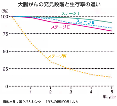 大腸がんの発見段階と生存率の違い