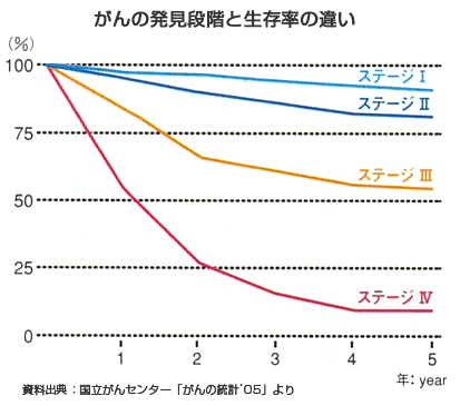 胃がんの発見段階と生存率の違い